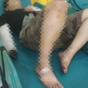 Tawuran Antar Dua Kelompok Pemuda di Ciomas, Polisi Lakukan Cek TKP