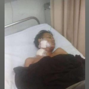 Hendak Menutup Warung, Seorang Pemuda Menjadi Korban Penyerangan OTK di Pakansari Cibinong